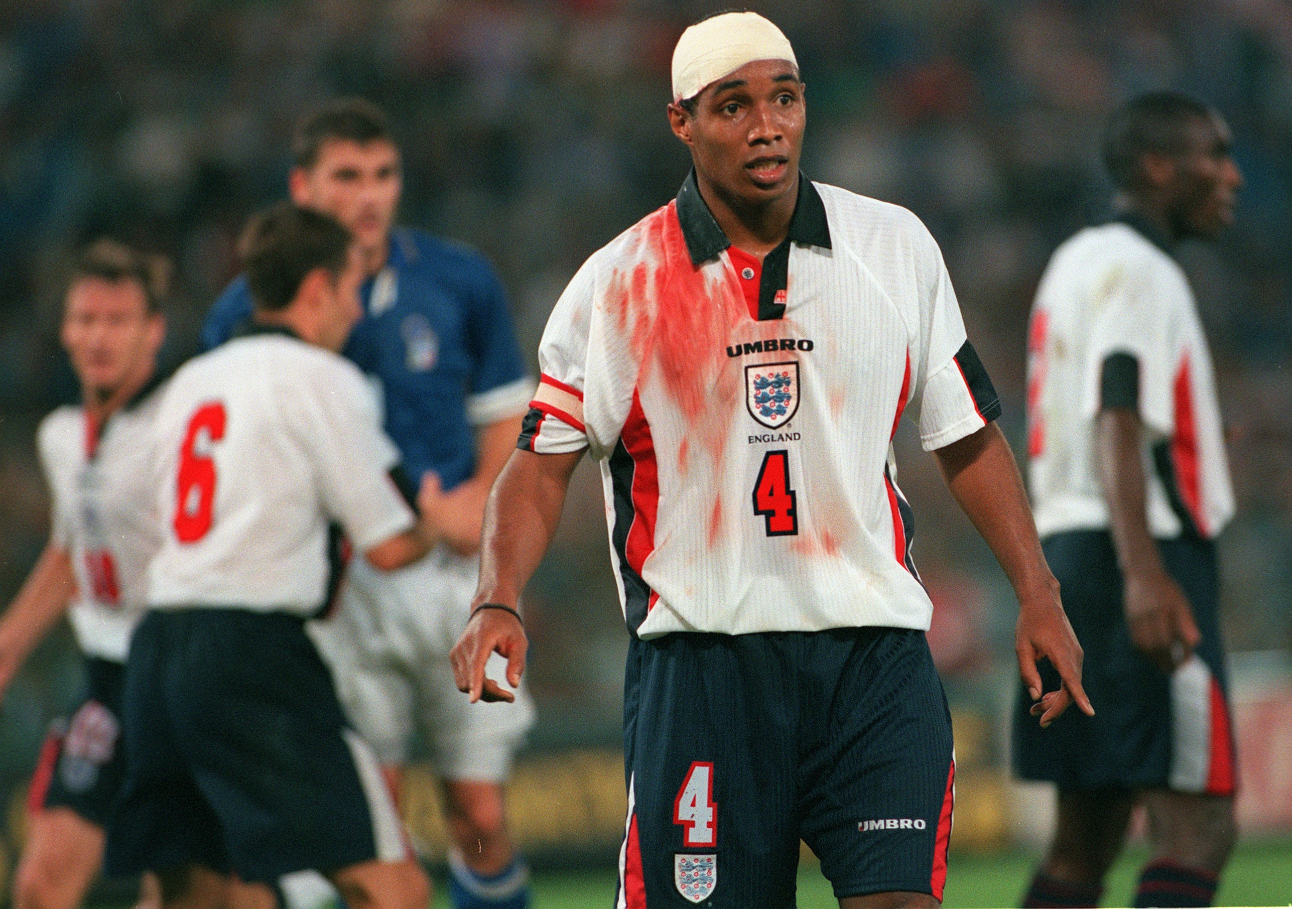 Paul Ince with a head injury during the 1997 World Cup