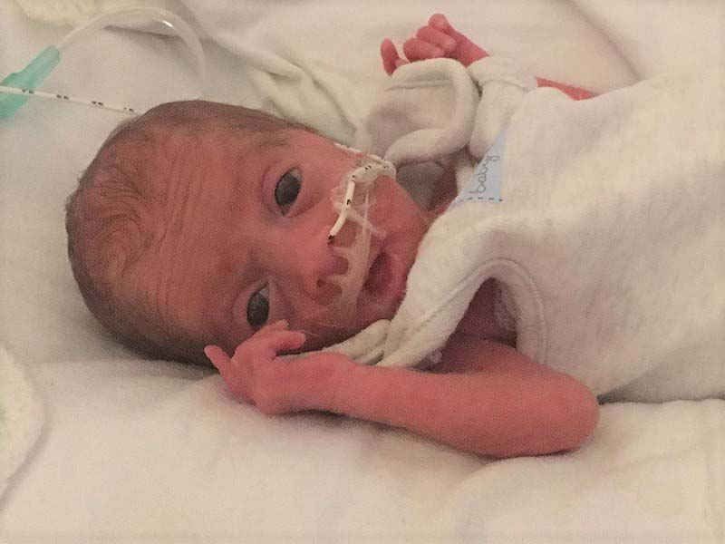 Baby Callum in the neonatal unit