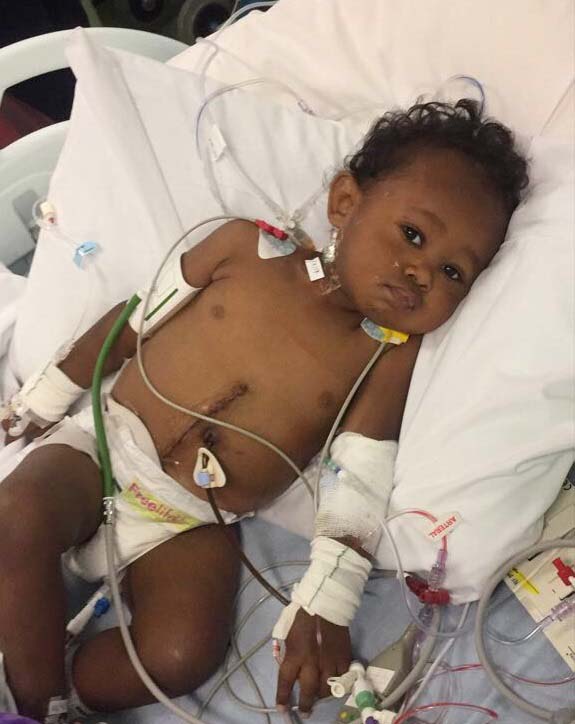 Child in a hospital bed after transplant