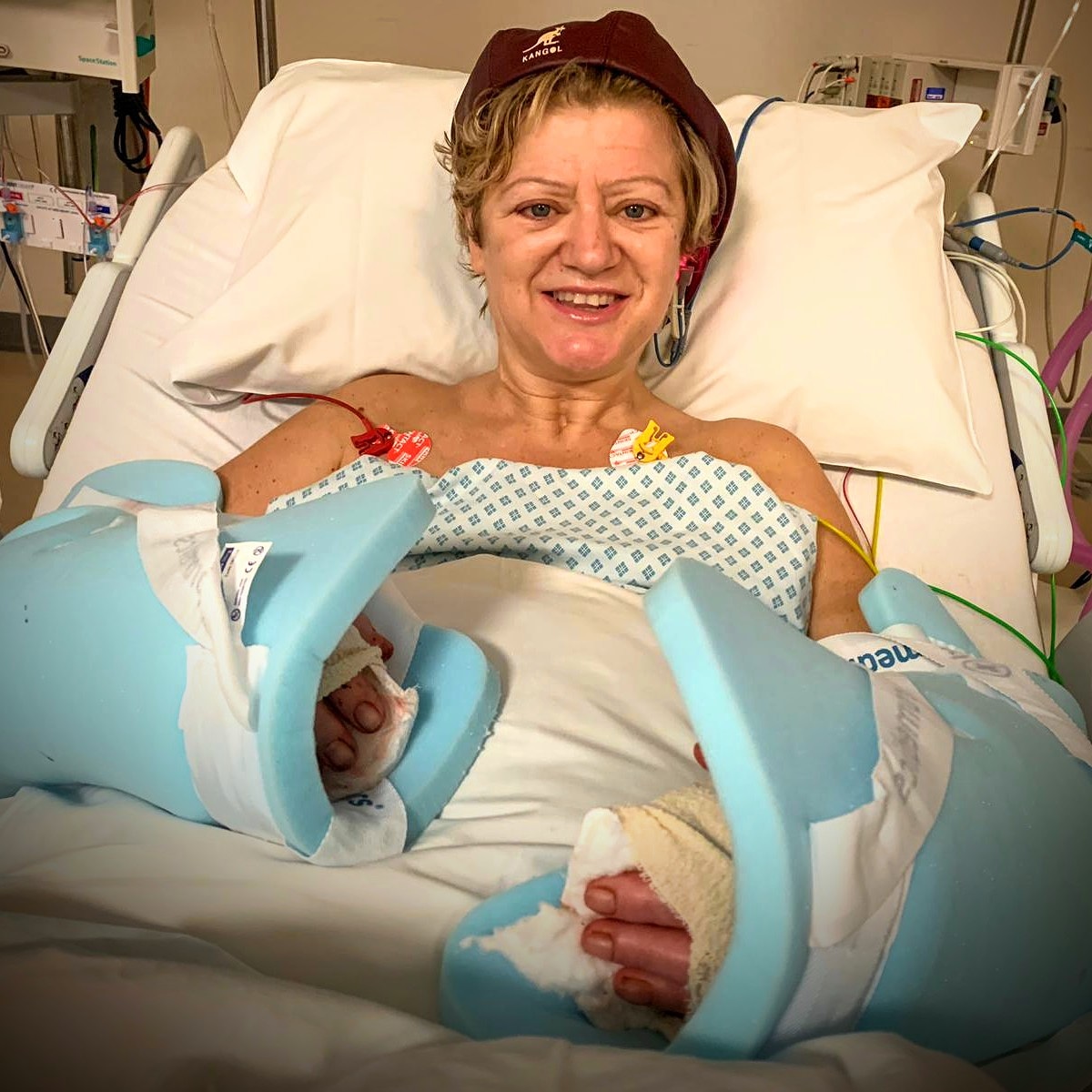 Corinne Hutton in hospital, after her operation