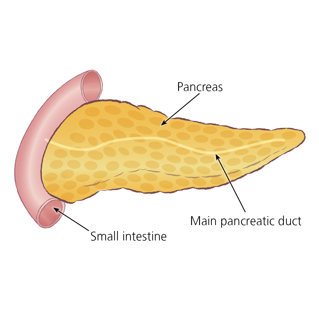 Illustration of pancreas showing positions of pancreatic duct and small intestine