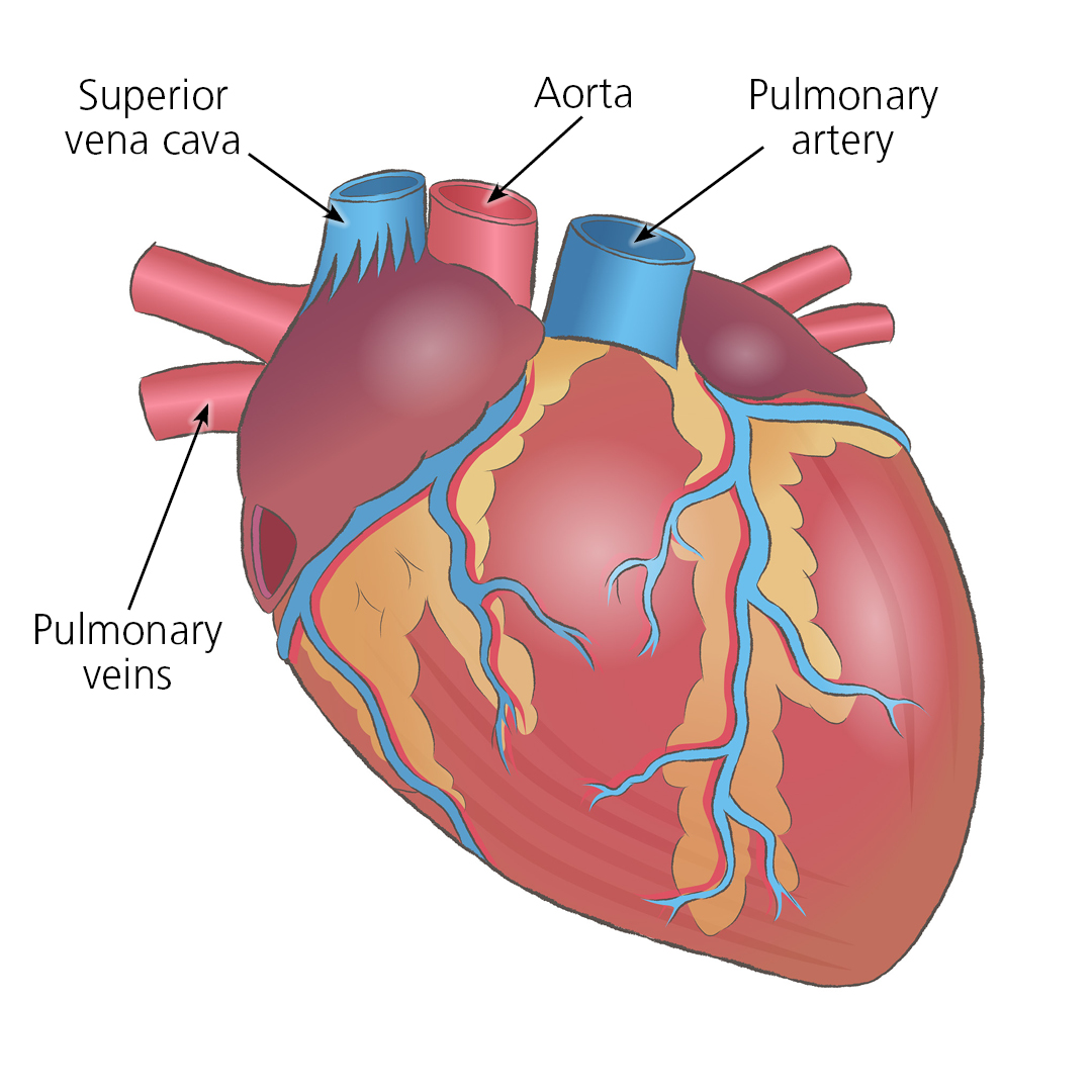 Close up illustration of a heart showing positions of superior vena cava, inferior vena cava, aorta and pulmonary artery