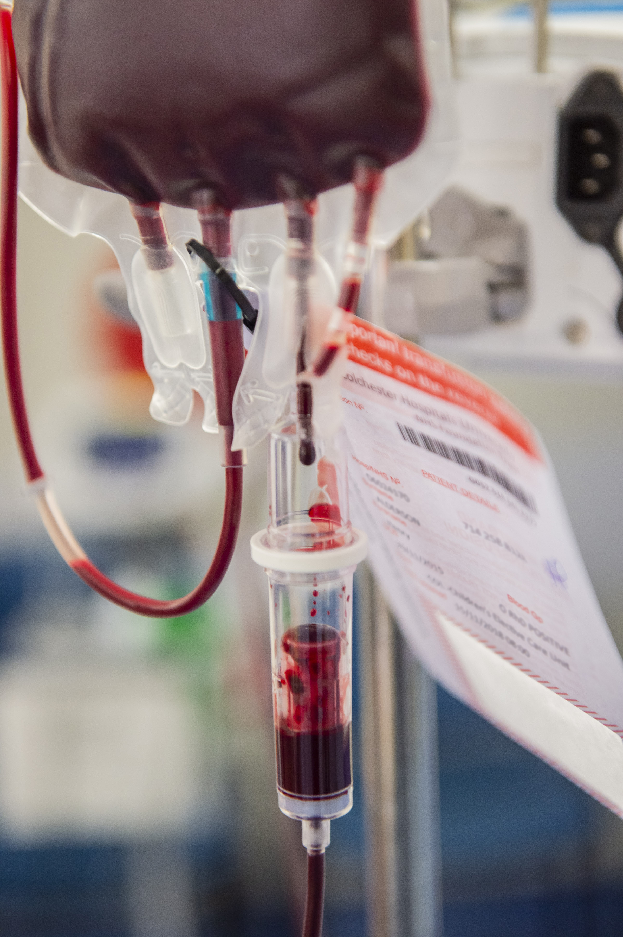 A blood bag during transfusion