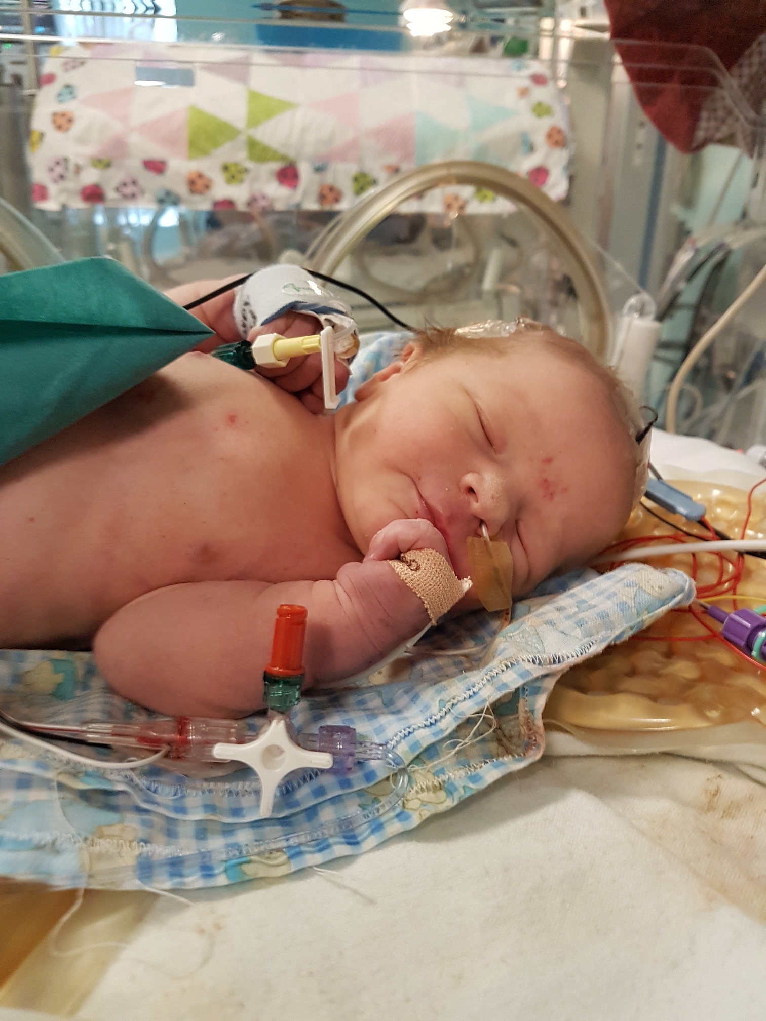 Trevor in the neonatal intensive care unit