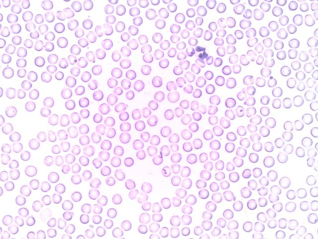 white blood cells images