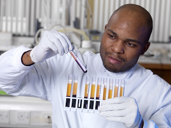 Image of a laboratory worker inspecting blood samples