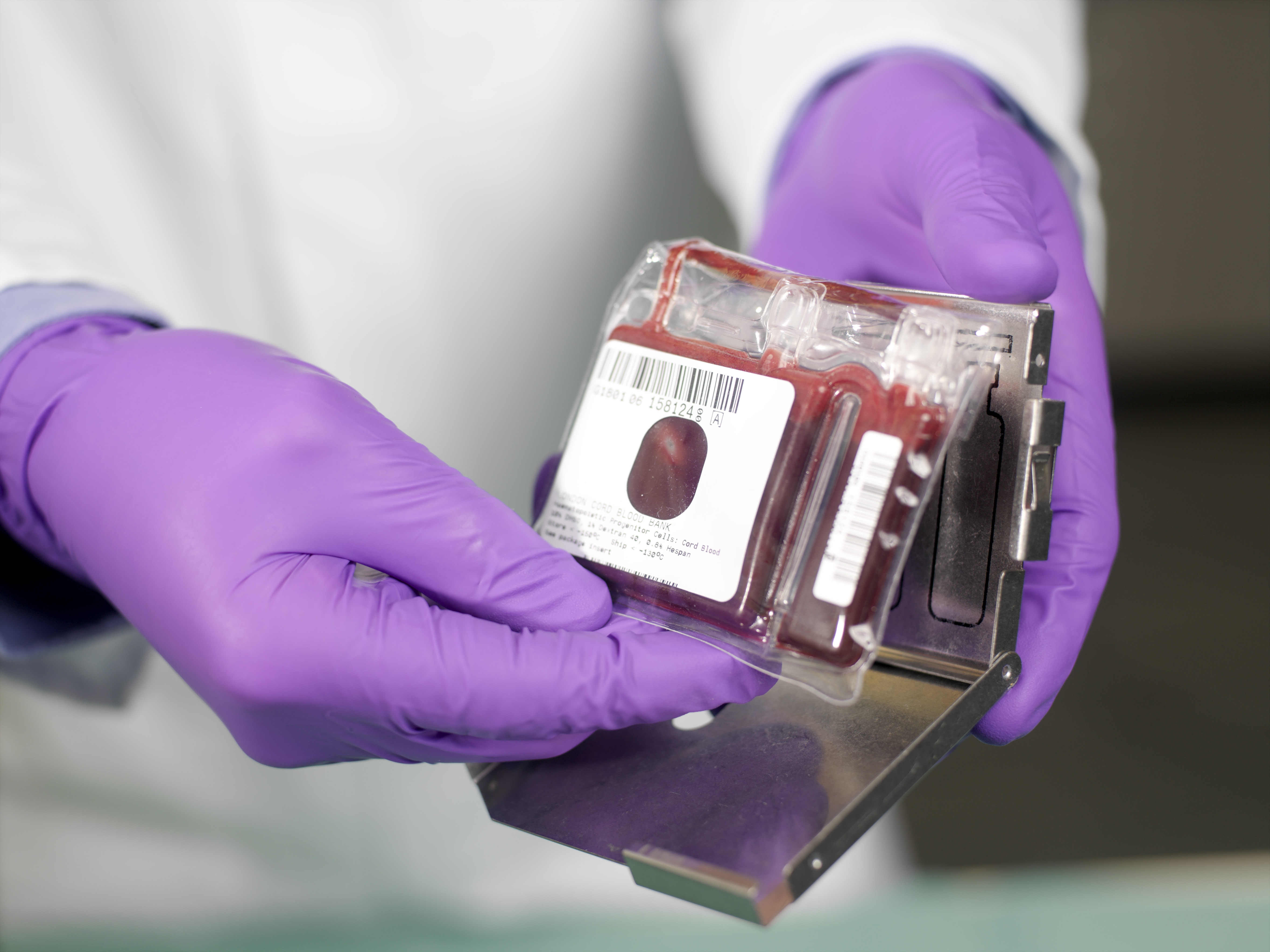 Image of a processed cord blood donation, ready for freezing